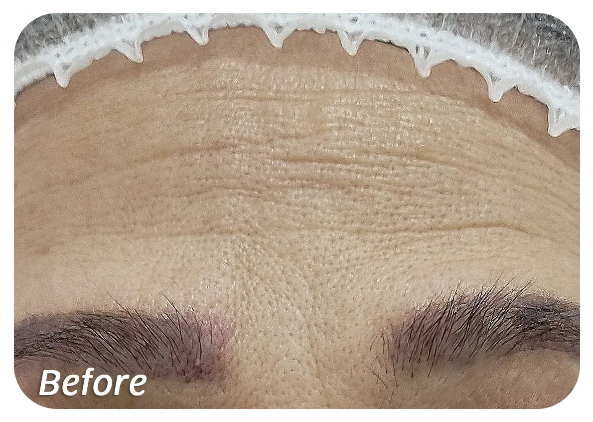 Before-Kerutan.png Before-Kerutan.png